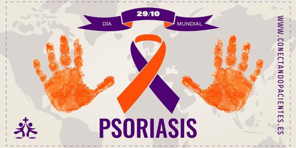 La Sociedad Argentina de Dermatología llevará adelante un encuentro virtual y gratuito por el Día Mundial de la Psoriasis