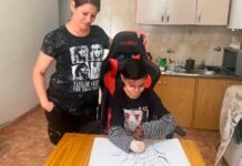 Tiene piel de cristal y una gran habilidad para dibujar: la historia de Juampi